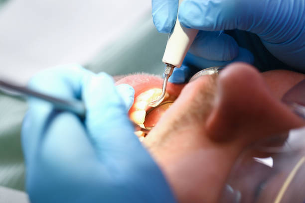 Best Orthodontic Emergency Dentist in Davis, OK