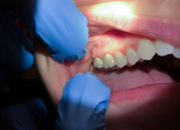 Best Weekend Emergency Dentist in Davis, OK