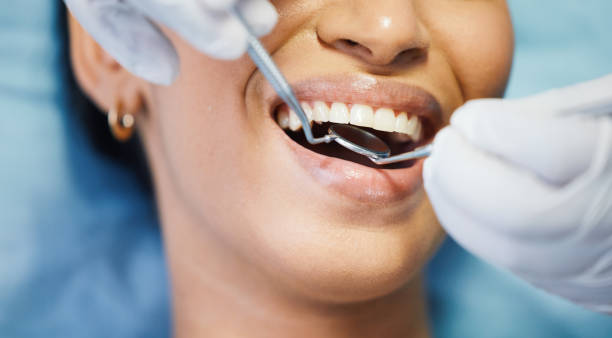Best Emergency Dentist for Lost Fillings or Crowns in Davis, OK